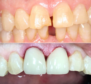 christina-greene-dentistry-before-and-after-photo3