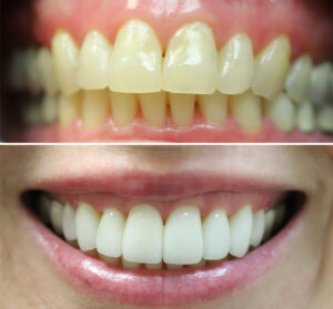 christina-greene-dentistry-before-and-after-photo6