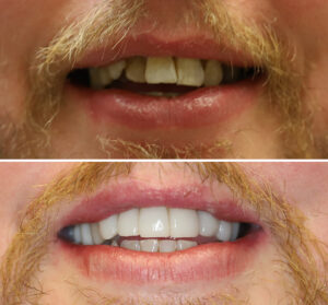 christina-greene-dentistry-before-and-after-photo9