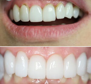 christina-greene-dentistry-before-and-after-photo10