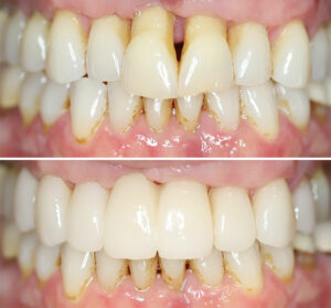 christina-greene-dentistry-before-and-after-photo13