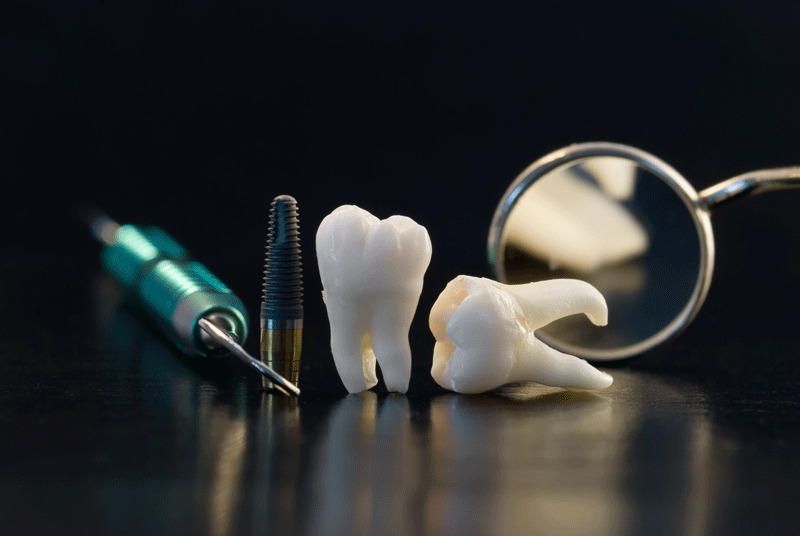 models of dental tools and implants and crowns on a reflective table.